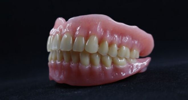 Quy trình làm Hàm Tháo Lắp tại Hải Hà Lab